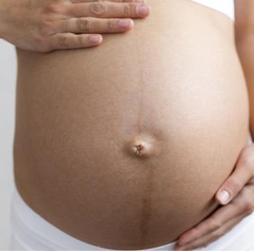 Гиперпигментация белой линии живота.